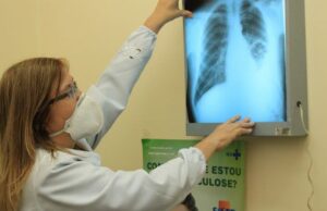 Prefeitura capacita equipes de saúde após aumento de casos de tuberculose em Dourados
